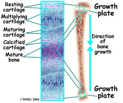 This is how bones grow in length and width. Bone growth centers are located throughout the body. During growth spurts, the tendon may not be able to keep up with the growth of the lower leg.