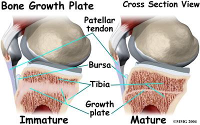 When the quadriceps muscle on the front of the thigh works, it pulls on the patellar tendon. The tendon in turn pulls on the tibial tuberosity.
