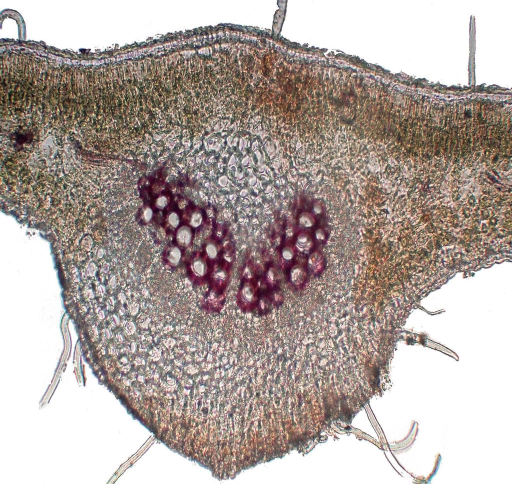 Trichome Anomocytic stomata Figure 3 Surface preparation of Moringa oleifera
