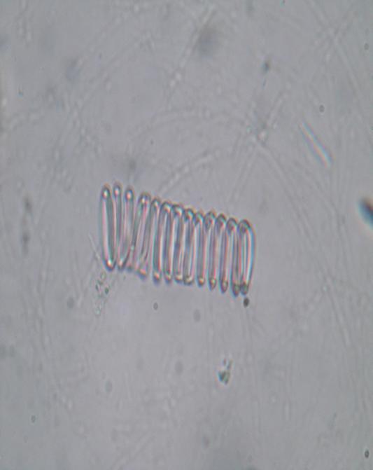 Greyish-green coloured powder shows groups of spongy parenchyma, anomocytic stomata, calcium oxalate crystals (Figure 4.