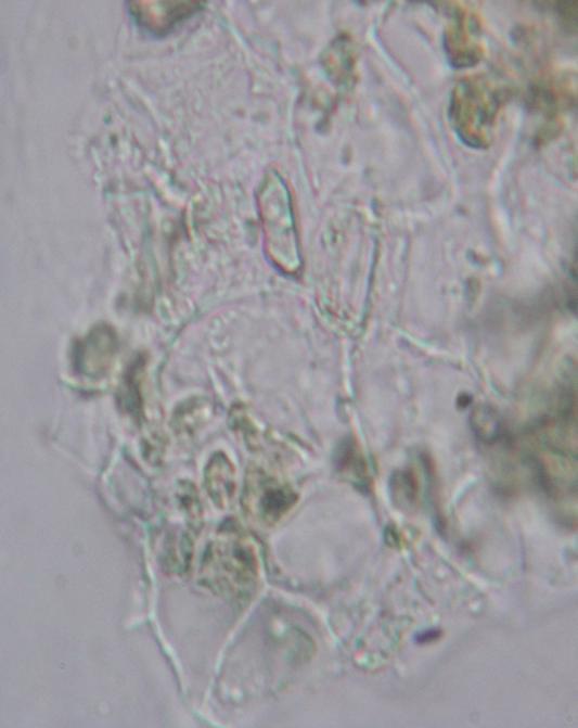 4); rosette crystals of calcium oxalate (Figure 4.5); cell containing pigment (Figure 4.6) and starch (Figure 4.7).