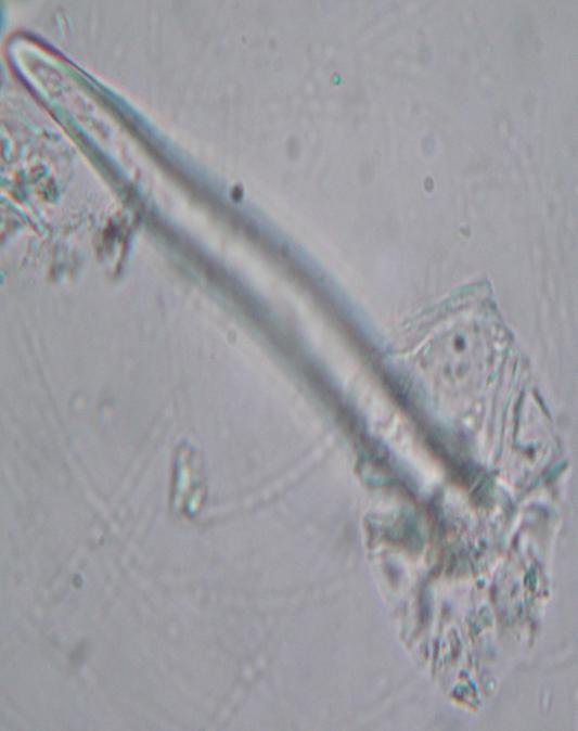 (40X) 4 Unicellular hairs with blunt