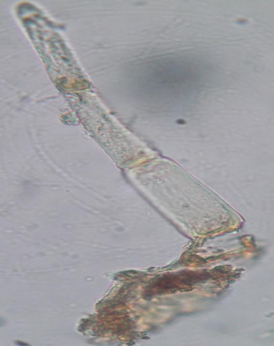oxalate 5 Parenchyma containing rosette
