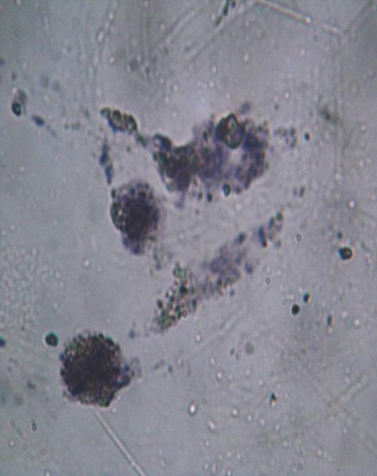 Figure 4.6 Cell containing pigment Figure 4.