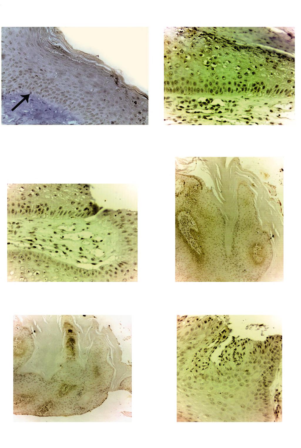 Ahmed A. Saleh, et al. 925 Immunohistochemical staining of TLR 3 using Avidin-Biotin complex. Fig.