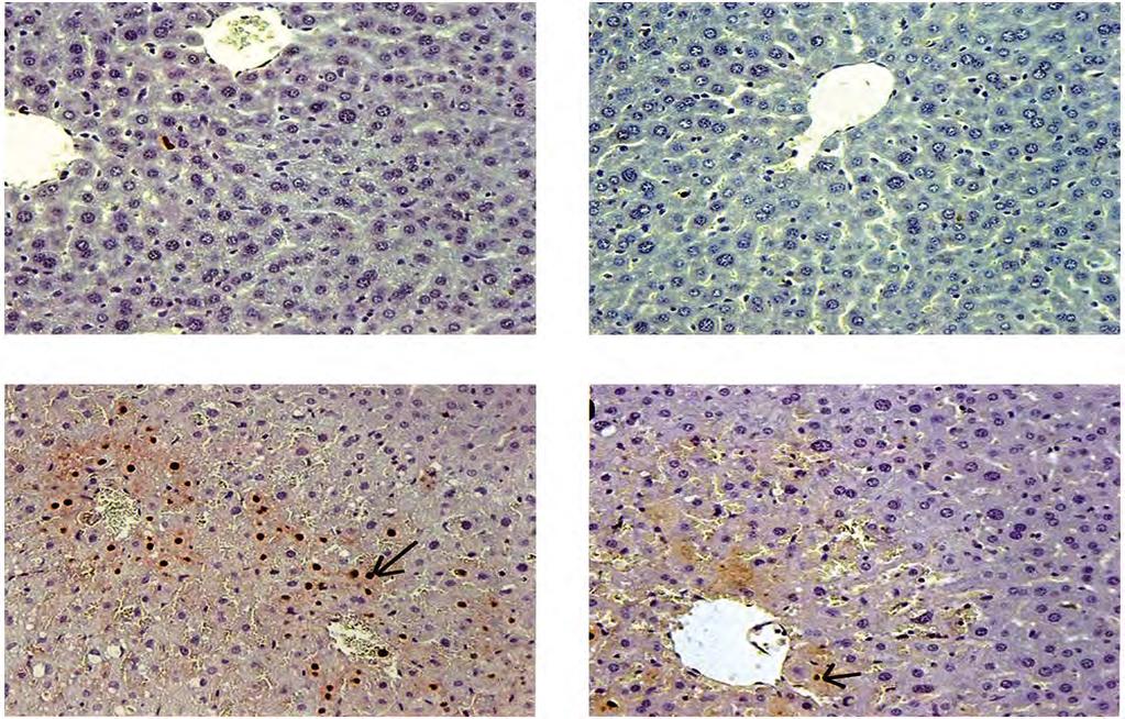 1030 Effects of Morin on Liver of Diabetic Rats (A) (B) (C) Fig. (4): Photomicrographs of liver sections stained with terminal deoxynucleotidyl transferase dutp nick end labeleing (TUNEL).