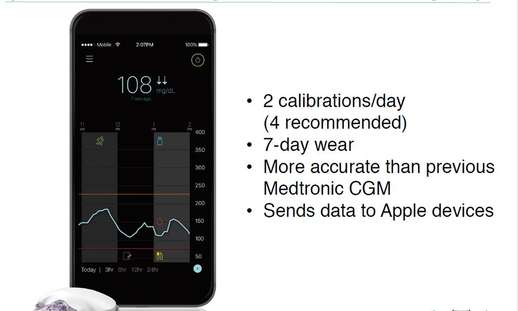 Medtronic Guardian Connect: