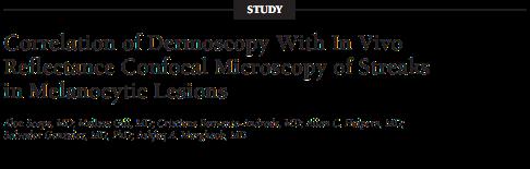 Direct Dermoscopy-RCM Correlations