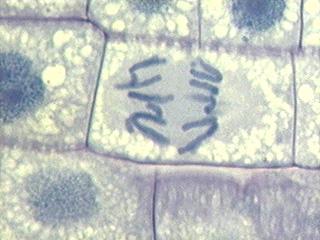 Anaphase In anaphase, the centromeres divide.