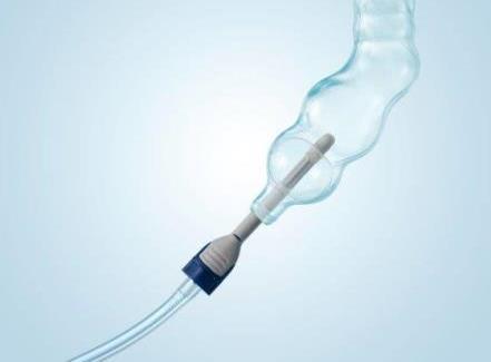 The catheter is inserted into the rectum. The balloon is inflated.