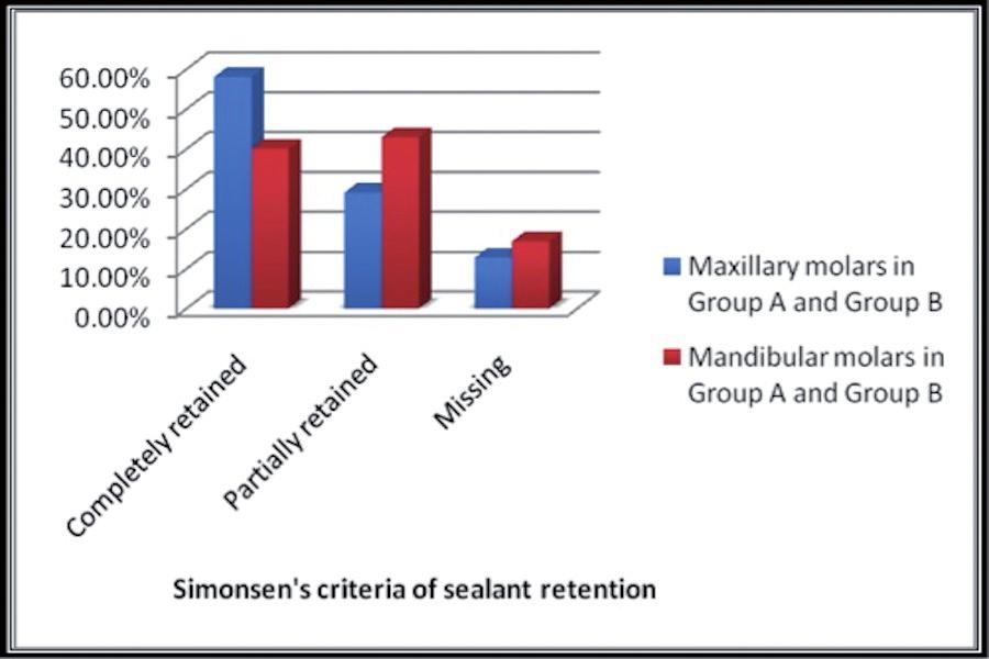 II. Results of sealant retention comparing Primary teeth (Maxillary + Mandibular) and Permanent teeth (Maxillary + Mandibular) after 3 and 6 months are shown in table 2.