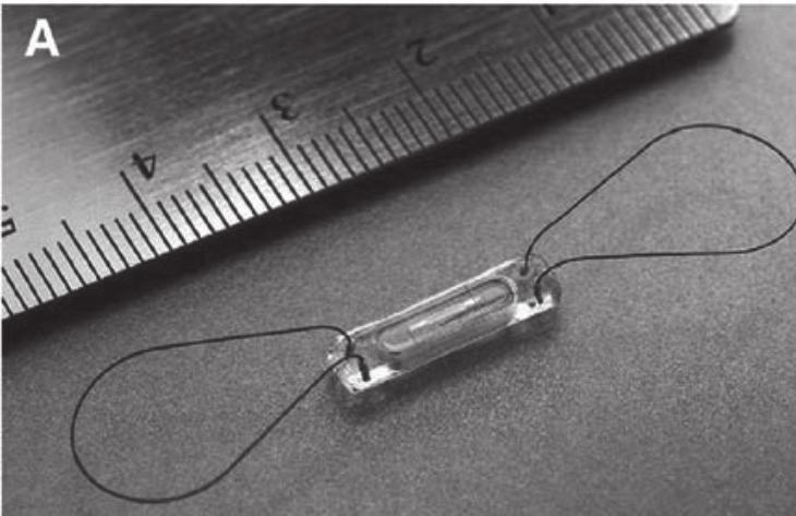 Numerio tema C 5 pav. HeartPOD kairiojo prieširdžio spaudimo stebėsenos sistema. A. Implantuojamoji sistemos dalis, sudaryta iš matuoklio laido ir antenos.