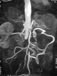 A major teaching hospital of Harvard Medical School Angiography: What are our goals?