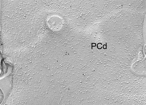 3 subunit are located on the P-face of fractured dendritic (PCd) and spine (s+) plasma membranes of a P22 mouse Purkinje cell.