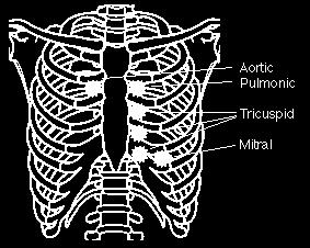 The pulmonary component of the second heart sound Murmur of patent ductus arteriosus Posterior 1. Left Atrial Area overlies the fifth, sixth, seventh and eighth posterior interspaces.
