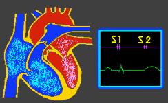murmur may still have a significant cardiac disease. Systolic Murmurs Most heart murmurs are systolic, occurring between S1 and S2. Systolic murmurs are either ejection or regurgitation murmurs.