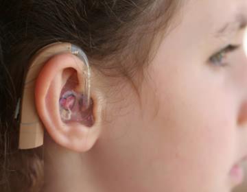 choice for those with profound hearing loss (especially at