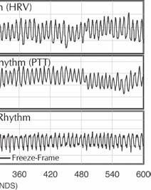 spectrum around 0.1 Hz. Most mathematical models show that the resonant frequency of the human cardiovascular system is determined by the feedback loops between the heart and brain.