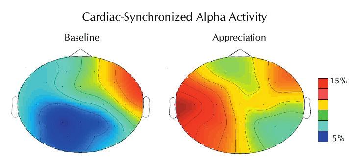 Figure 23. Alpha activity synchronized to the cardiac cycle.