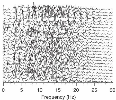 Extreme Negative Emotion and Emotional Quiescence for examples). There are also two sets of peaks that occur in most of the individual spectra in the range of 3 5 Hz and 7 8 Hz.