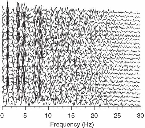 peaks occurring in the 3 5 Hz and 7 8 Hz ranges. This is due to the prominence of the low frequency rhythm in the HRV.
