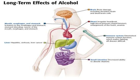 Cirrhosis is a disease caused by long-term alcohol use in which healthy liver tissue is replaced with scar