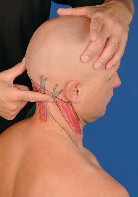 Two areas on the occiput exist that are covered by less firm muscles.