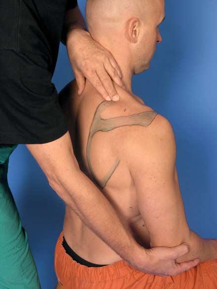 24 2 Shoulder Complex Fig. 2.11 Palpation of the superior angle of the scapula. (glenoid cavity) and is the direction for manual therapeutic traction at the GH joint.