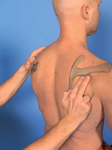 The inferior and superior edges of the spine of the scapula are palpated using the perpendicular technique with which we are already familiar.