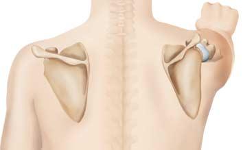 to lateral until it meets up with the posterior edge of the clavicle.