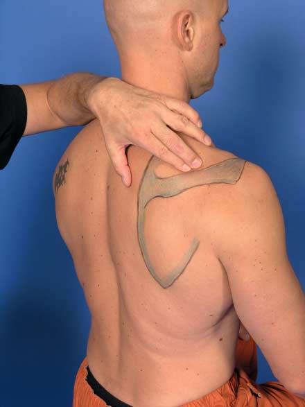 This palpation uses the same technique described in the palpation of the inferior edge (Fig. 2.15).