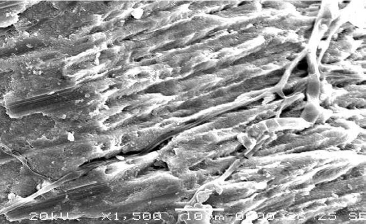 Scanning electron microscopic Figure 4. Scanning electron microscopic images - group III.