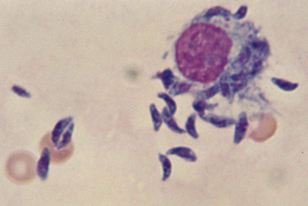 Toxoplasma gondii In ascitic fluid of a mouse.
