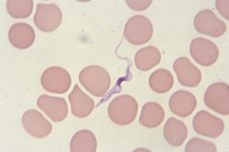 Trypanosoma brucei gambiense Slender form, 30 μm long, with kinetoplast, central nucleus, undulating membrane and long free