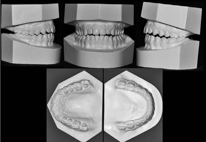 LATERAL CEPHALOMETRIC RADIOGRAPHY IN ORTHODONTICS 207 Figure 3. Pnormic rdiogrphs. Figure 1. Dentl cst photogrphs.