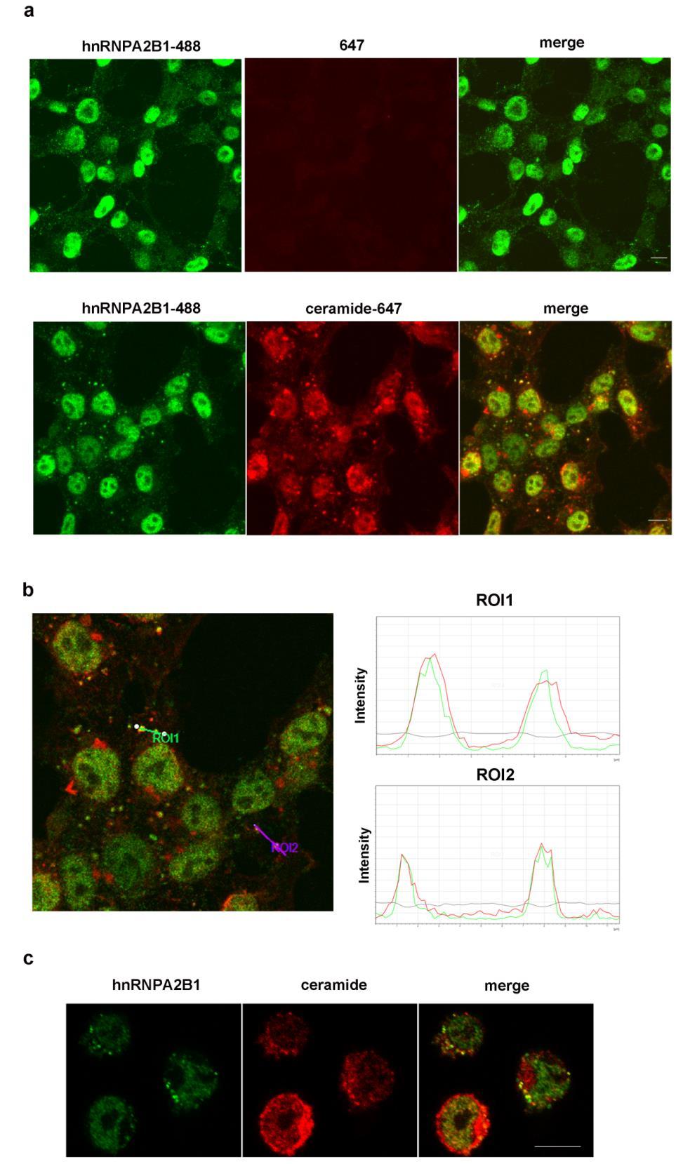 Supplementary Figure S5. HnRNPA2B1 presence in Multivesicular Bodies. (a) Confocal microscopy analysis of hnrnpa2b1 (green) and ceramide (red) colocalization in the cytoplasm of HEK293T cells.