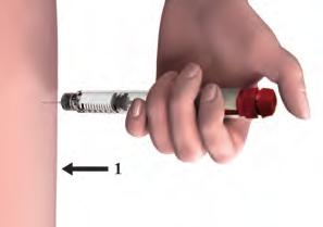 Hold the dose knob down for a minimum of 5 seconds to 6. Injecting the dose 6.1. Choose an injection site in the area your doctor or nurse has told you to give the injection.