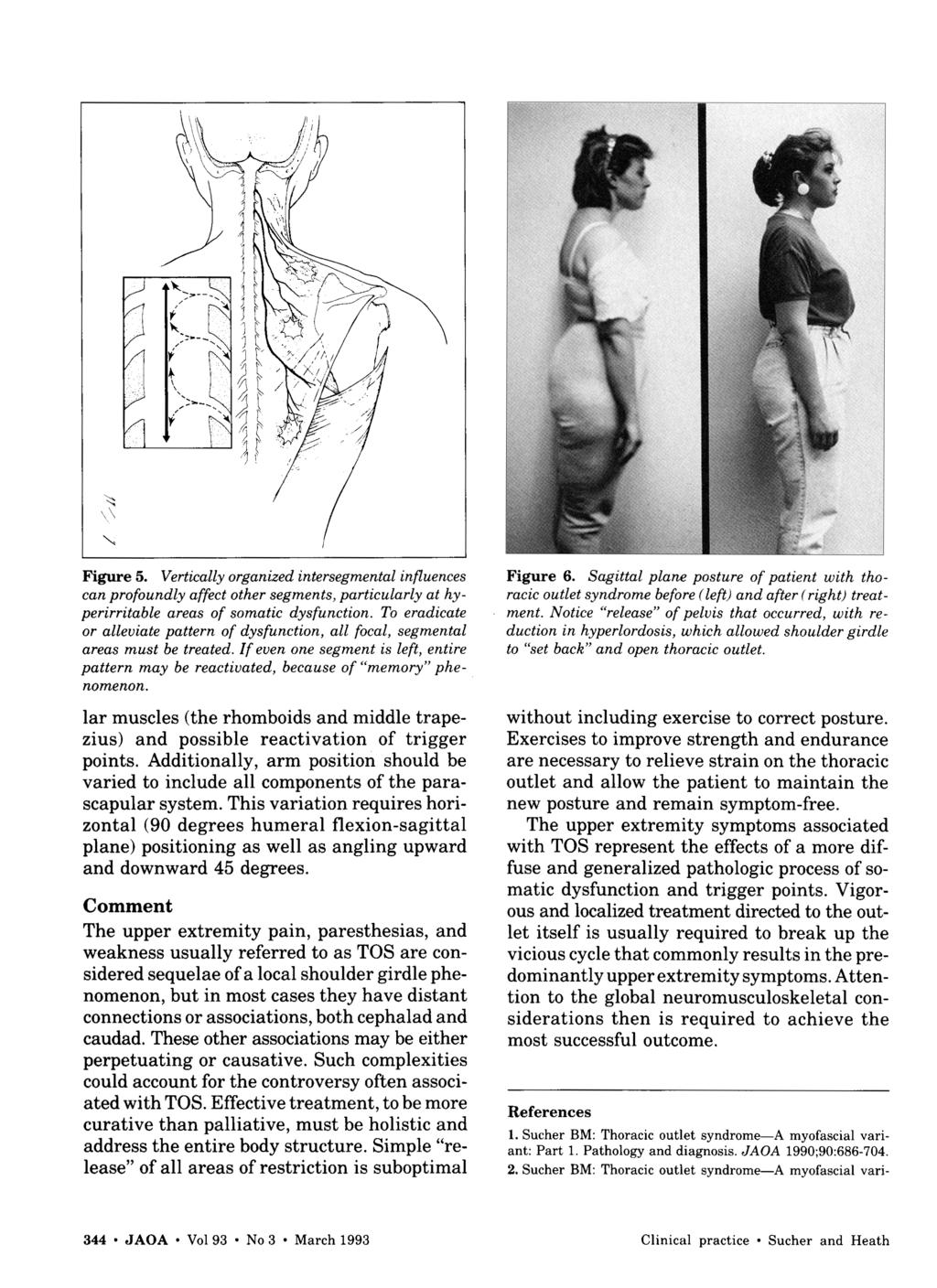 Figure 5. Vertically organized intersegmental influences can profoundly affect other segments, particularly at hyperirritable areas of somatic dysfunction.