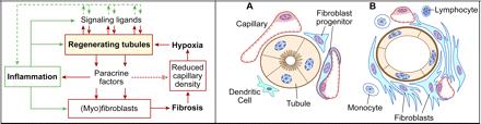 Cycle of Injury Leading to Fibrosis and Hypoxia Epithelial injury produces paracrine factors which potentiate injury through