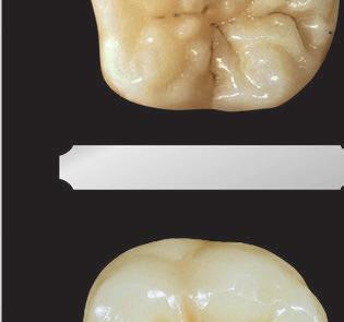 discovery The Tribos 501 teeth morphology is derived from the theory NFP Natural and Functional Prosthesis, result of