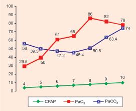 Effects of CPAP 17 Fig. 2.1: CPAP in RDS and relationship with PaO 2 and PaCO 2.