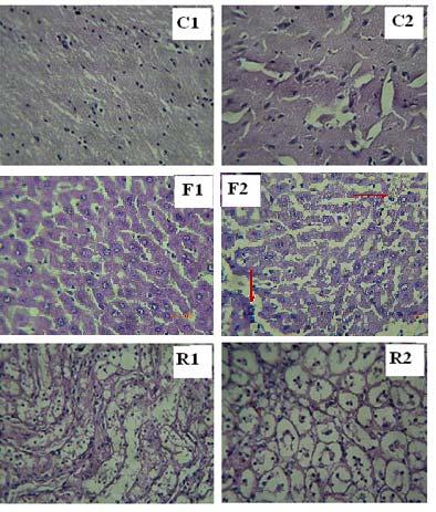 Toxicity study of the methanolic extract of Ajuga iva Figure 5. photomicrographs of the liver (F1 F2), the brain(c1 C2), and the kidney (R1 R2); scale enlargement: 40.