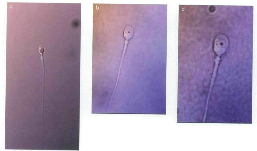 Novel selection methods for enhancing sperm quality - IMSI Selection of sperm