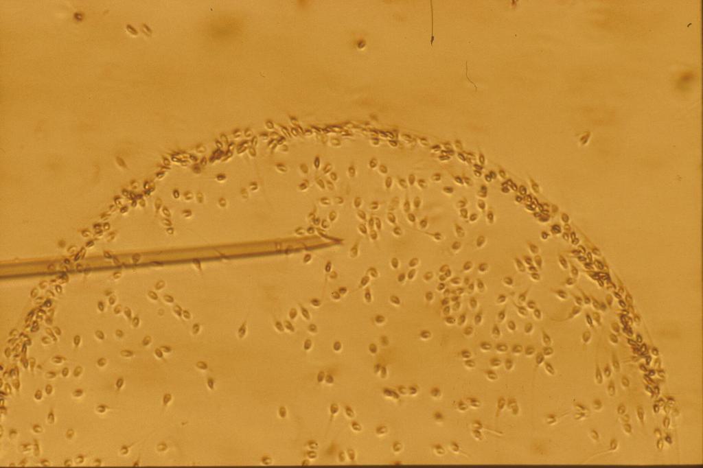 Selection of normal spermatozoa prior to ICSI using petri dishes coated with HA a
