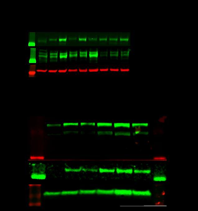 Supplementary Figure 12: Uncropped Western Blots (a) Uncropped Western Blot related to Figure 6d showing the expression of LCK and of its activated