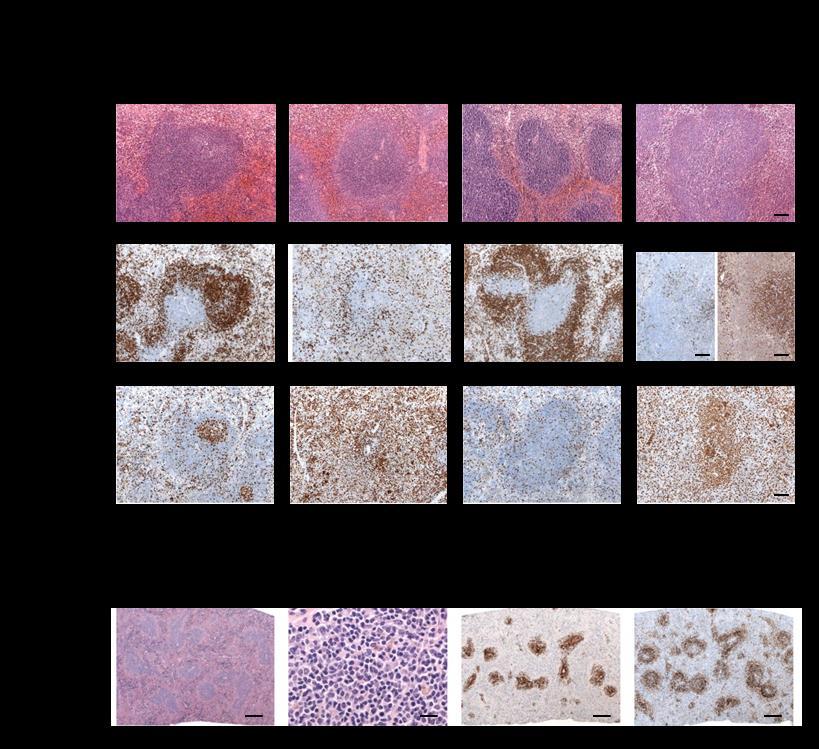 Supplementary Figure 6: Histopathological analysis of spleen sections from TCL1 Nfat2 -/- mice (a) H & E staining of paraffin-embedded spleen sections of representative TCL1 Nfat2 +/+ and TCL1 Nfat2