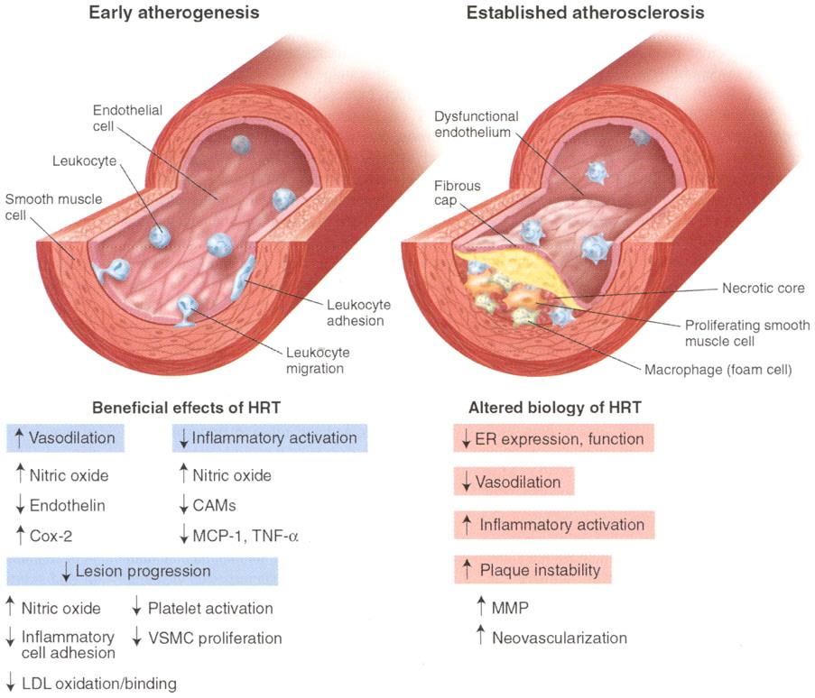 Vascular effects of estrogen Discontinuation possible adverse mechanisms: vasoconstriction