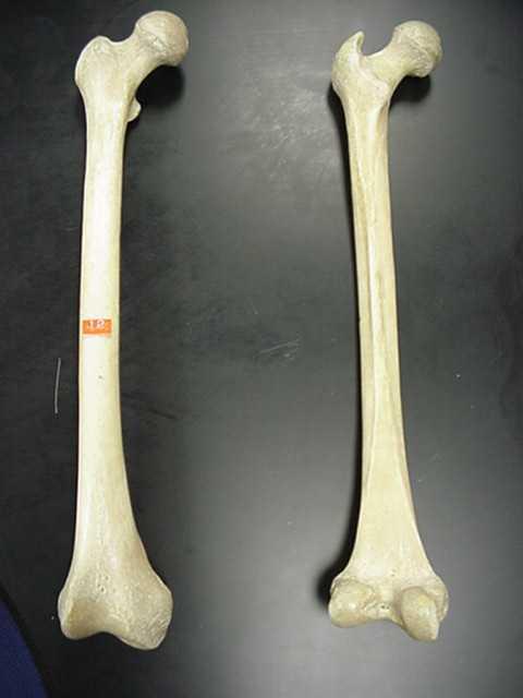 The Upper Leg or Thigh The upper leg has a single long bone, the femur and is the longest bone in the body.