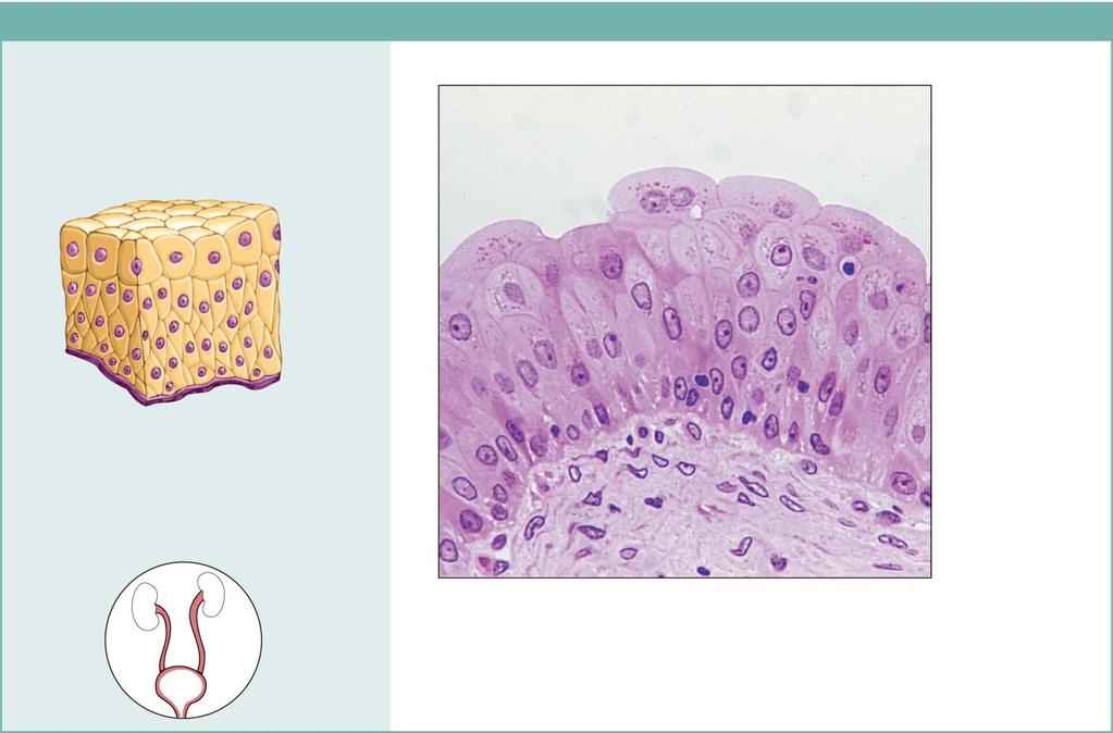 (f) Transitional epithelium Description: Resembles both stratified squamous and stratified cuboidal; basal cells cuboidal or columnar; surface cells dome shaped or squamouslike, depending on degree