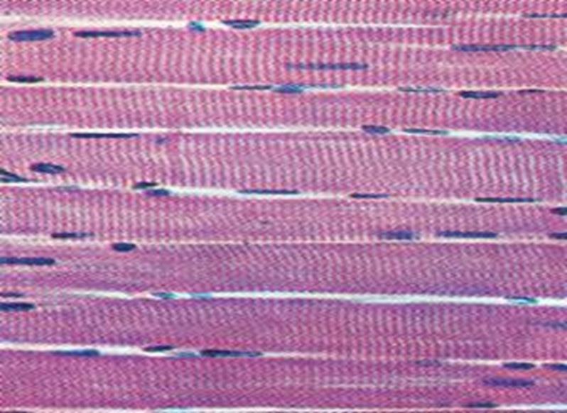 Skeletal Muscle Tissue Nuclei Muscle Fiber Found in Muscle that attach to bone.